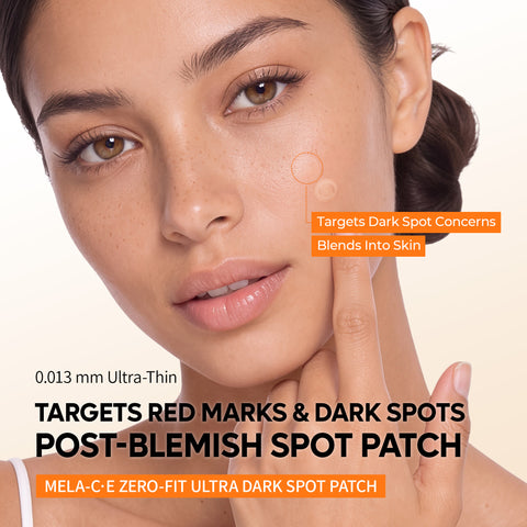 Zero Fit Blemish & Dark Spot Patch Duo