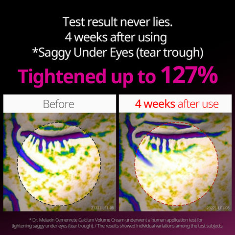 [FREE GIFT] Eye Care Essentials Set