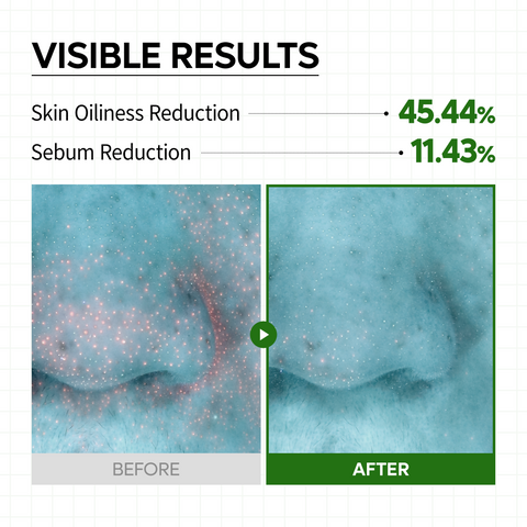 S-ZINC Vinegar Serum
