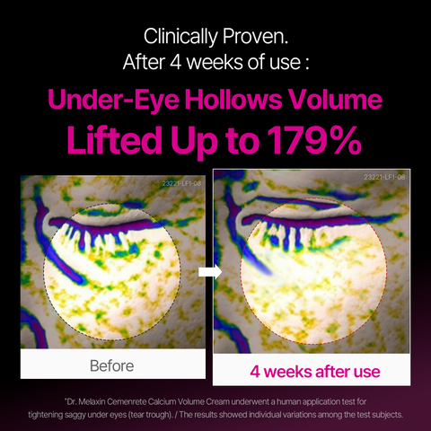 Calcium Eye Care Routine Set