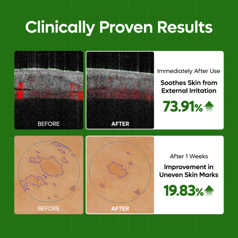 S-ZINC Vinegar Serum