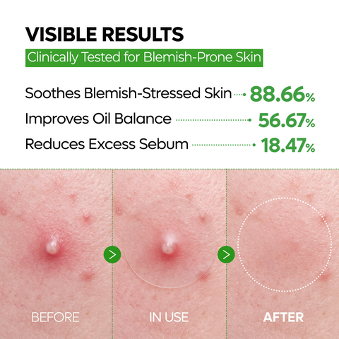 Zero Fit Blemish & Dark Spot Patch Duo