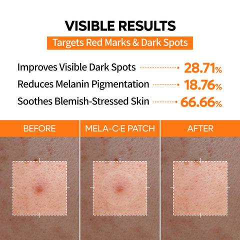 Zero Fit Blemish & Dark Spot Patch Duo