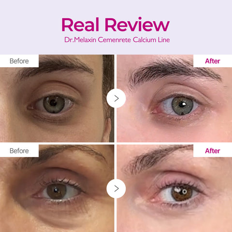 Calcium Eye Care Routine Set