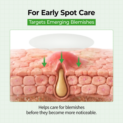 Zero Fit Blemish & Dark Spot Patch Duo