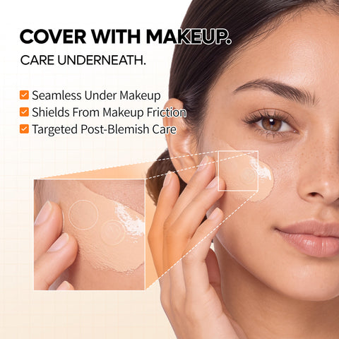 Zero Fit Blemish & Dark Spot Patch Duo