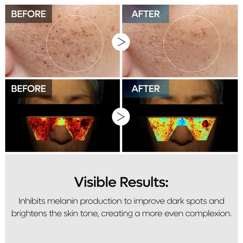 [SPECIAL BUNDLE] Full Brightening Care Set