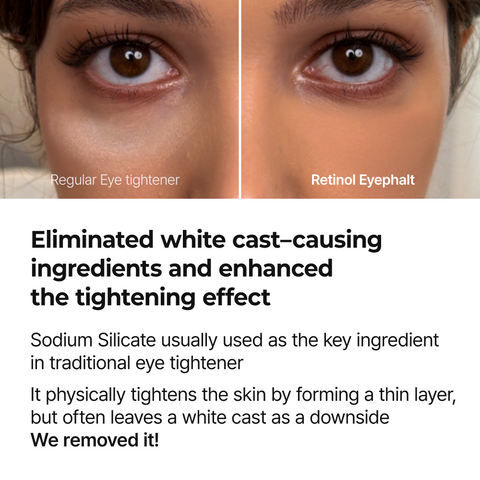 Retinol Eyebag Cream