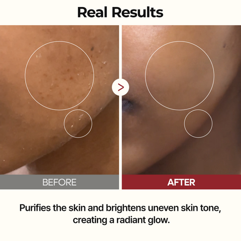 [FREE GIFT] Peel Shot Ric Exfoliating Softening Series