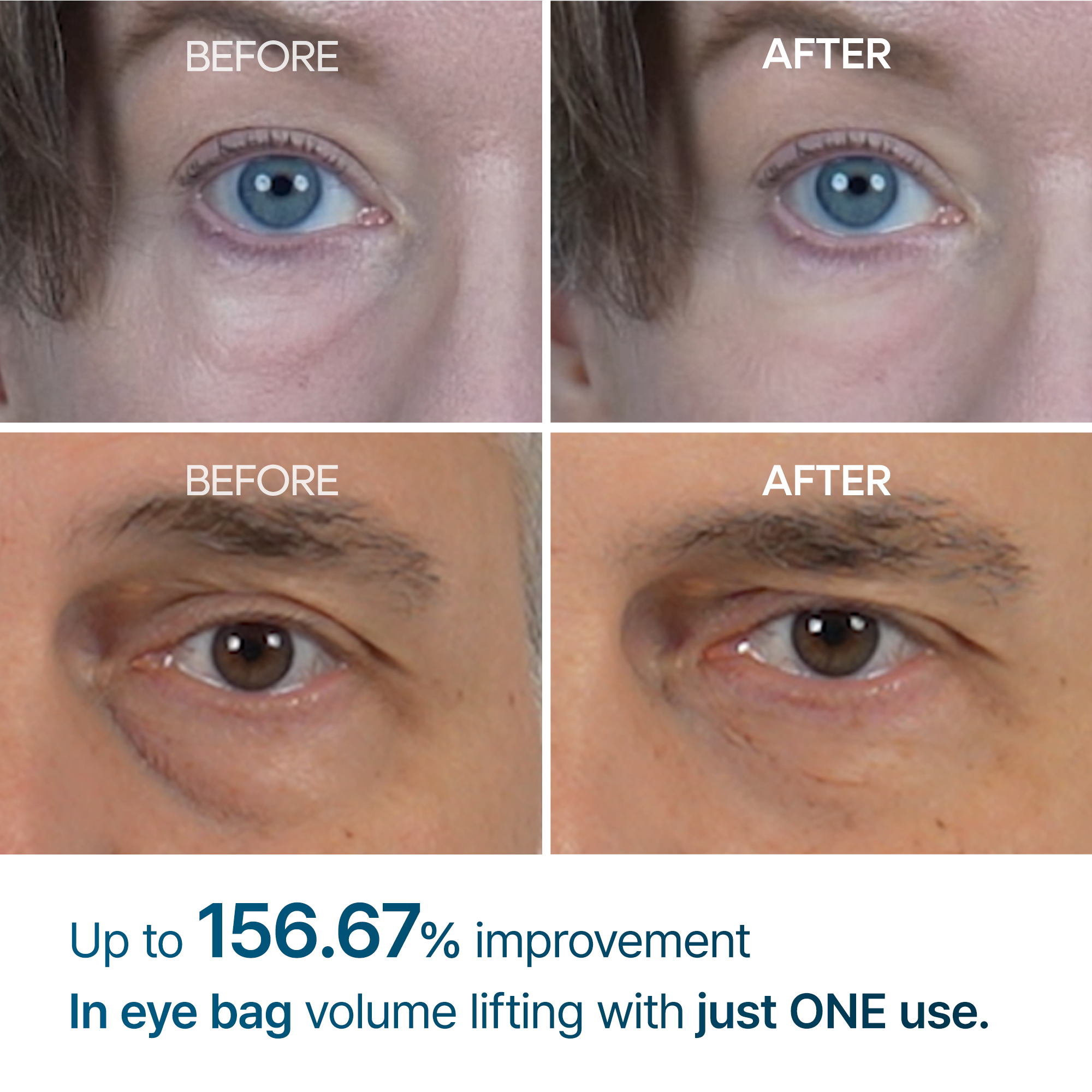 [FREE GIFT] Eye Care Essentials Set