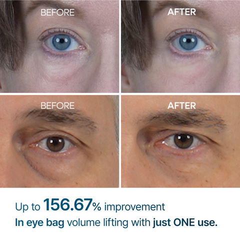 [FREE GIFT] Eye Care Essentials Set