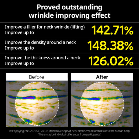 [HOLIDAY EXCLUSIVE] Total Renewal Elite Set
