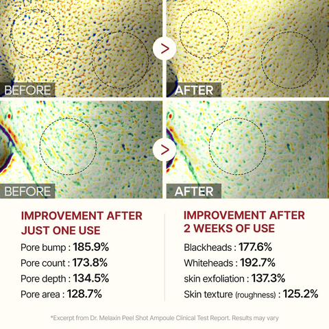 Peel Shot Glow Rice Ampoule Duo